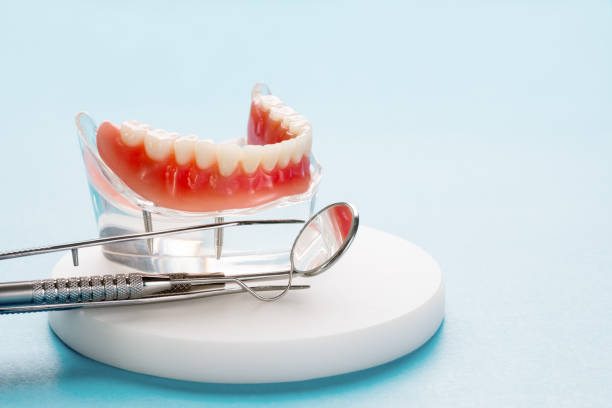 Full Mouth Reconstruction in Quinlan, TX